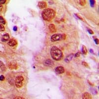 NOS2 / iNOS Antibody (N-Terminus)