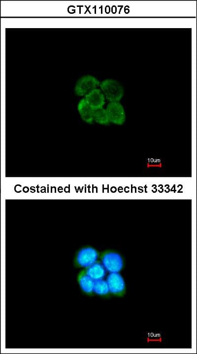 IHC-plus™ SERPINF2 / Alpha-2-Antiplasmin Antibody (aa188-453)