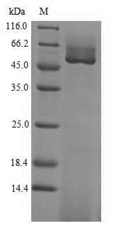 Soybean Guanine nucleotide-binding protein subunit beta-like protein (Recombinant 6His-SUMO, N-terminus)