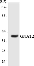 GNAT2 Antibody (aa34-83)