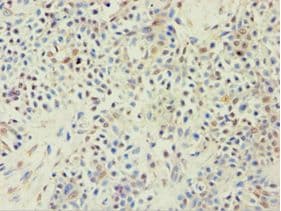 ABCF2 Antibody (aa1-250)