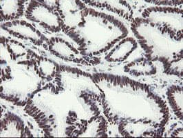 MLF1 Antibody (clone OTI3A3)