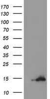 CST3 / Cystatin C Antibody (clone OTI2C11)
