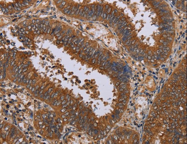 NPTX1 Antibody
