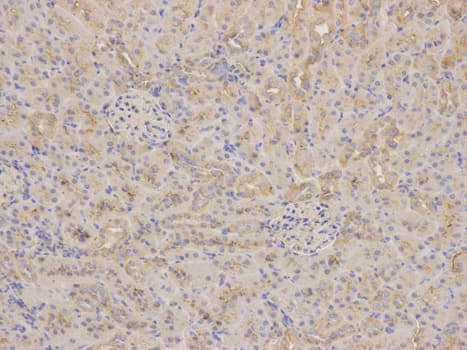IHC-plus™ DDX / AKR1C3 Antibody