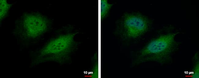 IHC-plus™ CSRP2BP Antibody