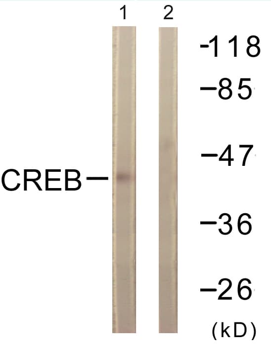 IHC-plus™ CREB1 / CREB Antibody (aa91-140)