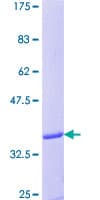 Human Neuropeptide Y / NPY Protein (Recombinant GST)