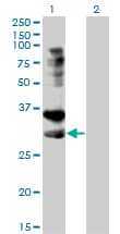 PathPlus™ TNFRSF14 / CD270 / HVEM Antibody (clone 2G6-2C7)