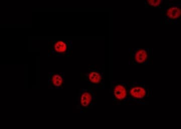 DHX8 Antibody