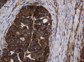 ASGR2 Antibody (clone OTI2A12)