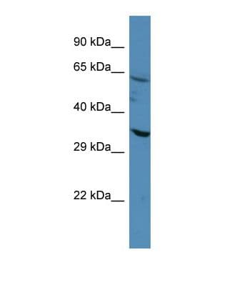 CASP4 / Caspase 4 Antibody (aa161-210)