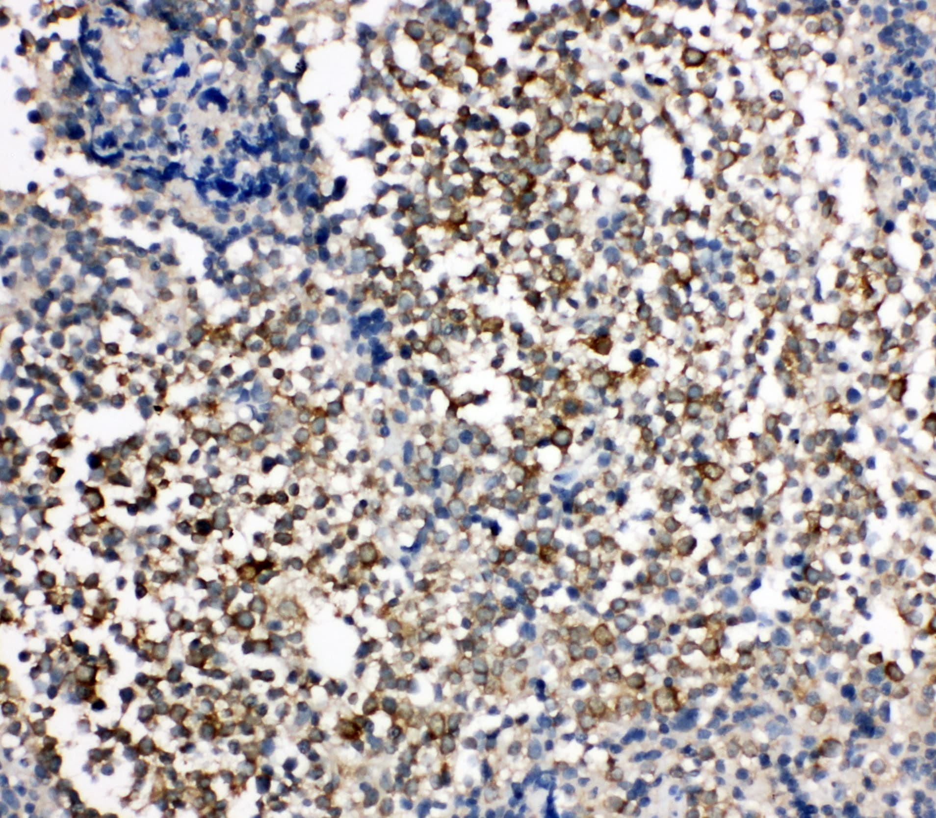 HAVCR1 / KIM-1 Antibody (aa332-348)