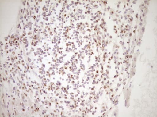 LPIN1 / Lipin 1 Antibody (clone OTI8F10)