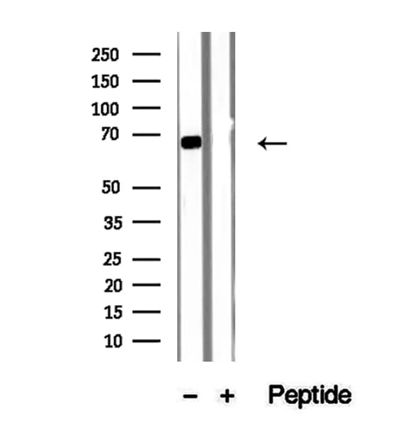 Polyclonal Rabbit anti-Human SDC3 / Syndecan 3 Antibody (IHC, IF, WB)