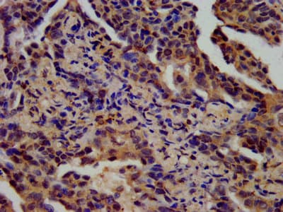 SPINK6 Antibody