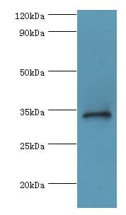 Polyclonal Rabbit anti-Human HYLS1 Antibody (aa70-299, IHC, WB)