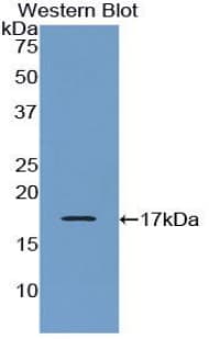 CRH / CRF Antibody (aa28-160)