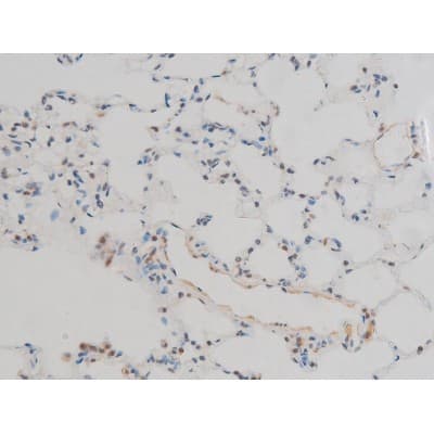 Polyclonal Rabbit anti-Human GFAP Antibody (phospho-Ser38, IHC, IF, WB)
