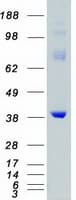 Human MAP2K6 / MEK6 / MKK6 Protein (Recombinant Myc-DDK (Flag))