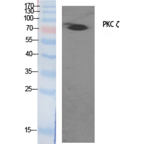 Polyclonal Rabbit anti-Human PRKCZ / PKC-Zeta Antibody (500-580 aa, IHC, IF, WB)