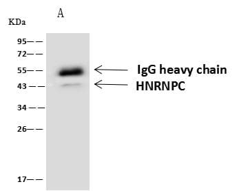 Polyclonal Rabbit anti-Human HNRNPC / HNRNP C Antibody (IHC, IF, WB)