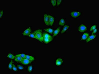 IHC-plus™ PFDN1 Antibody
