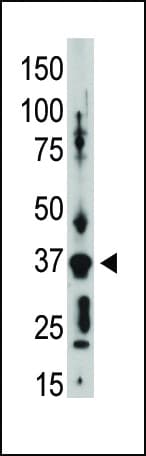 GJD2 / CX36 / Connexin 36 Antibody (aa291-321)