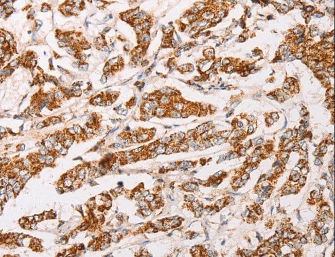 Polyclonal Rabbit anti-Human AK2 / Adenylate Kinase 2 Antibody (IHC, WB)