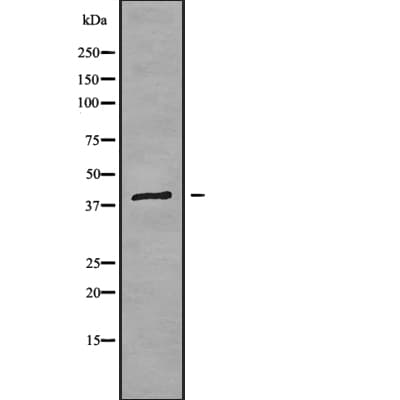 CYP4Z1 Antibody