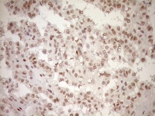 NR1H3 / LXR Alpha Antibody (aa69-329, clone OTI1A5)