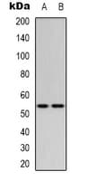 Polyclonal Rabbit anti-Human TP53 / p53 Antibody (C-Terminus, WB)