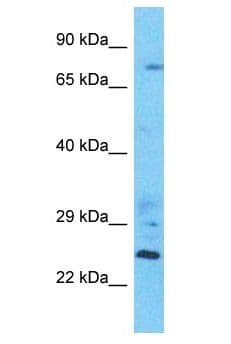 Polyclonal Rabbit anti-Human LSG1 Antibody (aa609-658, WB)