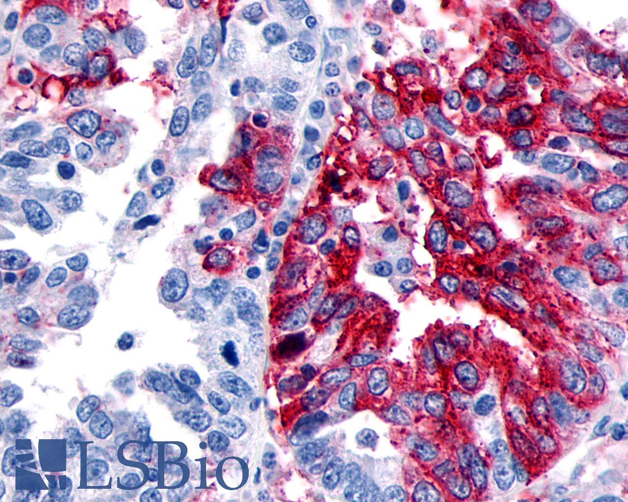 PathPlus™ ADGRD1 / GPR133 Antibody (Cytoplasmic Domain)