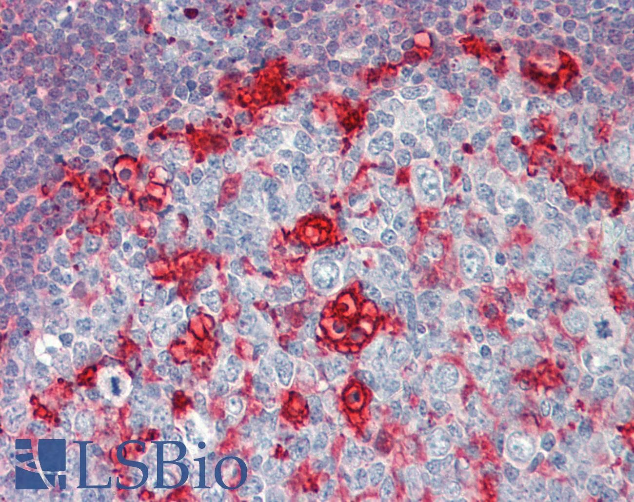 IHC-plus™ CAPG Antibody (aa205-217)