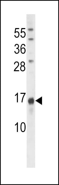 Osteocalcin Antibody (aa2-32)