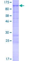 Human KIAA1586 Protein (Recombinant GST)