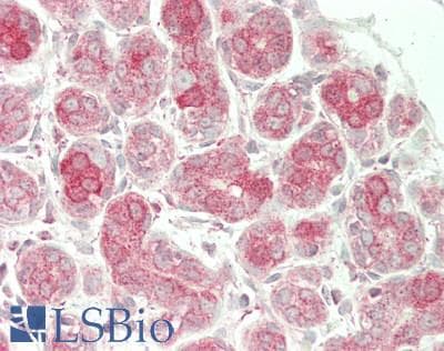 IHC-plus™ Polyclonal Rabbit anti-Human SEPT7 / Septin 7 Antibody (aa319-368, IHC, WB)