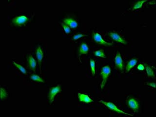 Polyclonal Rabbit anti-Human VAC14 / TRX Antibody (IF)