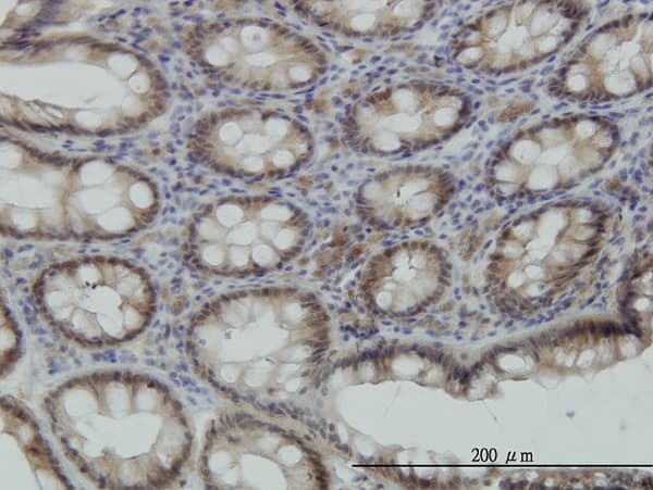 Monoclonal Mouse anti-Human STK38 Antibody (clone 2F6, IHC, IF, WB)