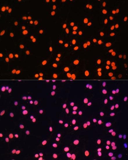ZNF581 Antibody