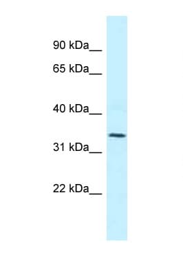 Polyclonal Rabbit anti-Human BM022 / MRPL1 Antibody (aa51-100, WB)