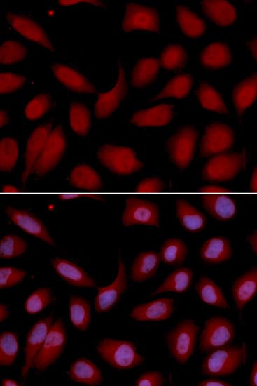Polyclonal Rabbit anti-Human CD3E Antibody (IHC, IF, WB)