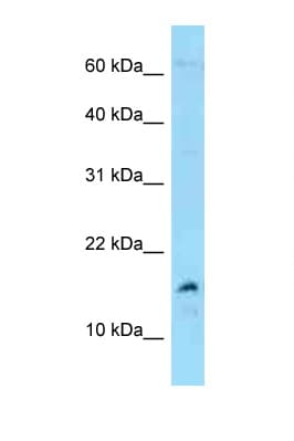 MDK / Midkine Antibody (C-Terminus)