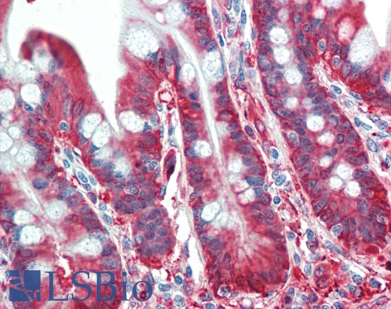 PathPlus™ ALDH1A1 / ALDH1 Antibody