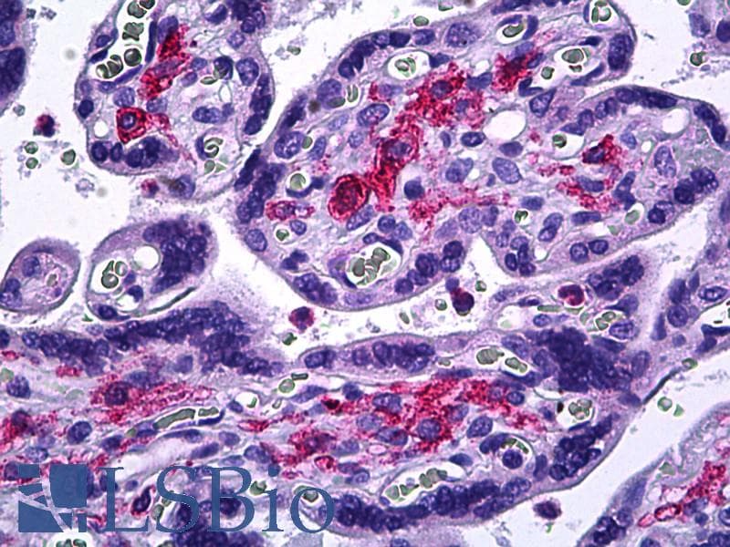 IHC-plus™ Polyclonal Rabbit anti-Human MMP11 Antibody (aa61-110, IHC, IF, WB)