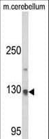 CLIP1 / CLIP-170 Antibody (aa228-254)