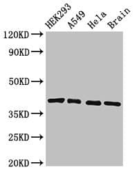 Polyclonal Rabbit anti-Human HLA Class I Histocompatibility Antigen, C-4 Alpha Chain Antibody (IHC, WB)