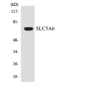 SLC5A6 / SMVT Antibody (aa543-592)