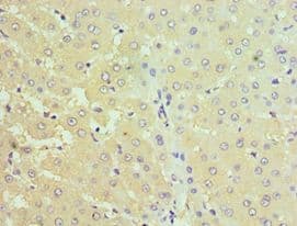 STC1 / Stanniocalcin Antibody (aa18-247)